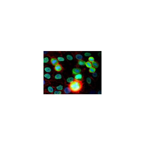 Ku80 Antigen / DNA helicase p80 antibody (MEM-54)