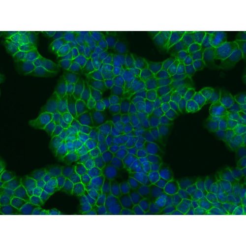 beta-Catenin antibody (EM-22)