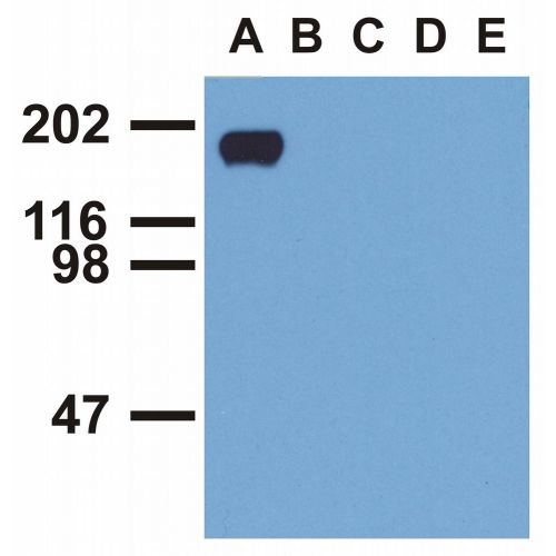 EGFR (Phospho-Tyr992) antibody (EM-12)