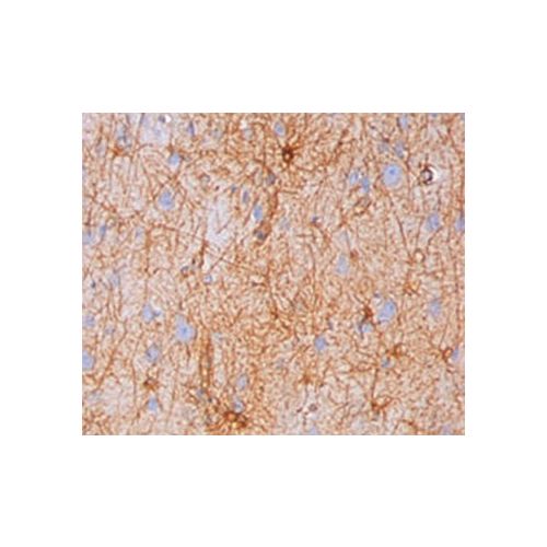 GFAP antibody (GA-5)
