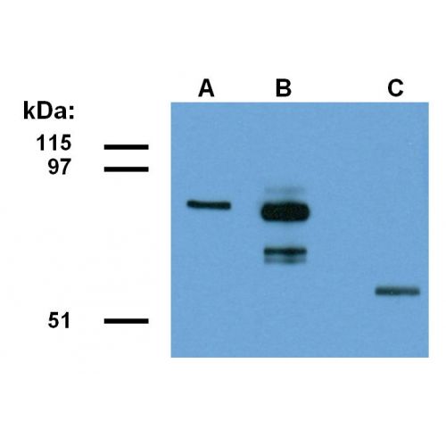 ABRA1 antibody (ABRA1-01)