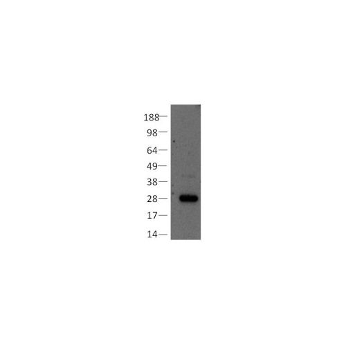 Bcl2 antibody (Bcl-2/100)