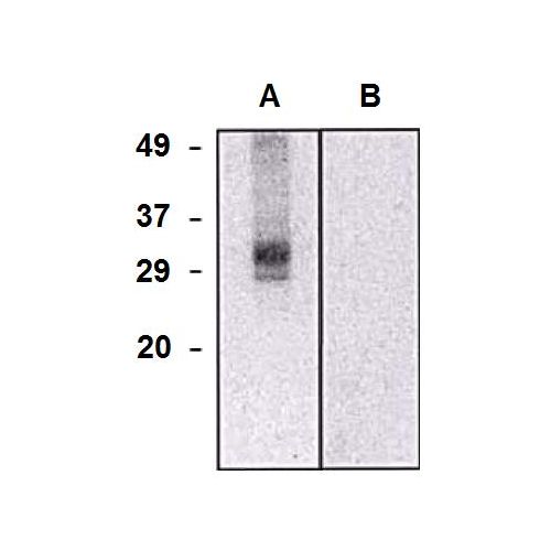 CLIC5a antibody (CLIC5-02)