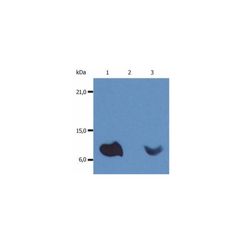 beta2-Microglobulin antibody (B2M-01) [HRP]