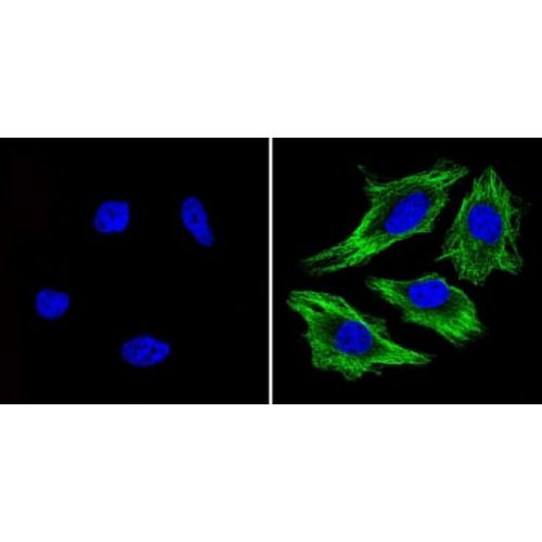 Beta-tubulin antibody (BT7R)