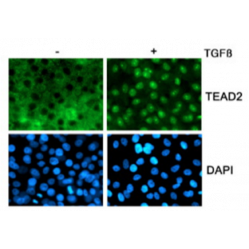 TEAD-2 antibody