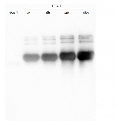 WB - Homocitrulline antibody<br/>Anti-Homocitrulline WB staining of human albumin (HSA T) or human carbamyl-albumin (HSA-C) at different levels of carbamylation.