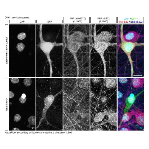 EB2 pS222 antibody
