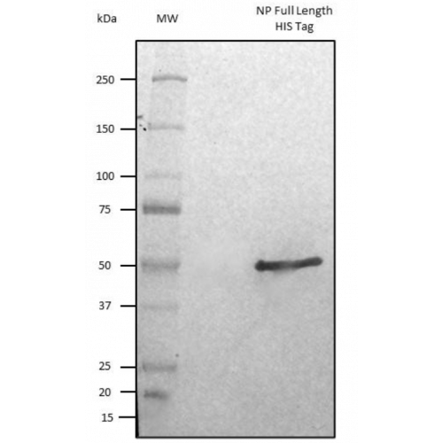 SARS-CoV-2 Nucleoprotein – HEK – His Tag