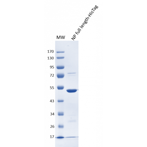 SARS-CoV-2 Nucleoprotein (N) – E. Coli – his tag