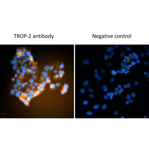 Immunofluorescent staining analysis on MCF 7 (HER2/neu status normal) cells. Cells were fixed in 100% Methanol and stained with pab01038-p (dilution 1/200) followed by Goat Anti-rabbit IgG- Alexa 555 (dilution 1/2000). <br/>DAPI nuclear. <br/>PBS instead 
