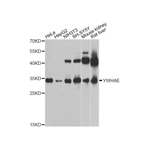 Western Blot - YWHAE / 14‑3‑3 Epsilon Antibody<br/>(pab77789)<br/>Western blot analysis of extracts of various cell lines, using YWHAE antibody at 1:1000 dilution. The secondary antibody used was an HRP Goat Anti-Rabbit IgG (H+L) at 1:10000 dilution. Lysa