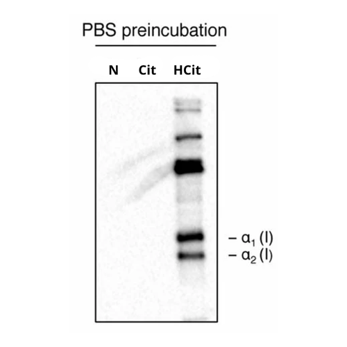 Homocitrulline antibody