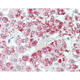 SLC7A2 (Internal) antibody