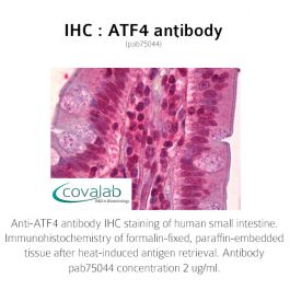 ATF4 antibody