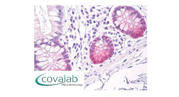 Glutathione Peroxidase 2 (GPx-2) antibody