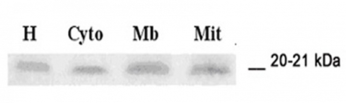 collagen plus glutathione Glutathione Peroxidase | Inhibitors main image 0