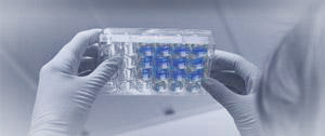 Custom antibody development